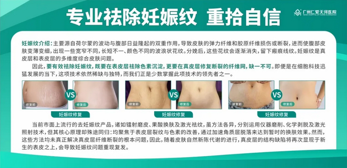 广东省最好的疤痕医院，专业治疗疤痕，重塑患者信心