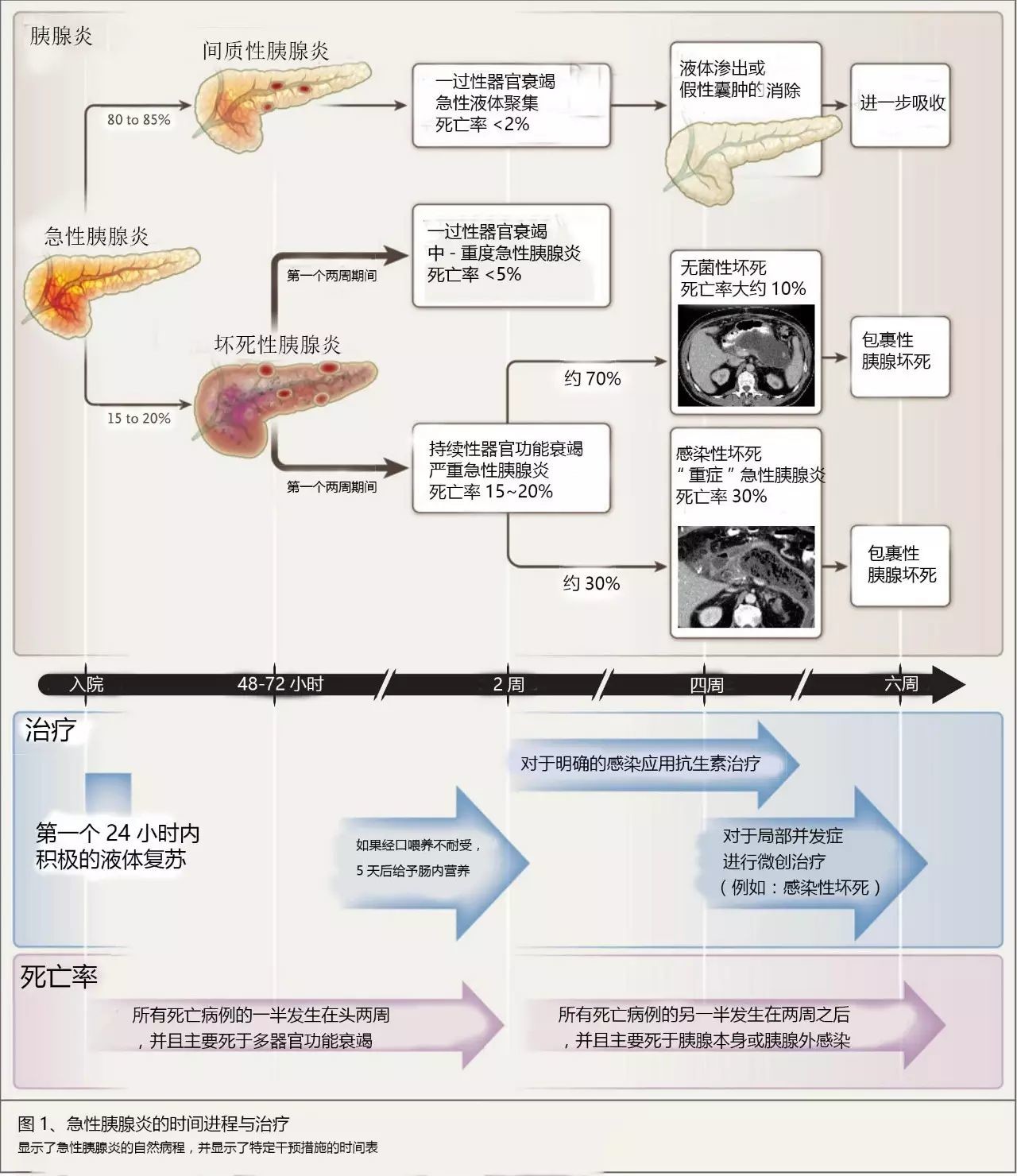 急性胰腺炎最新论文研究综述