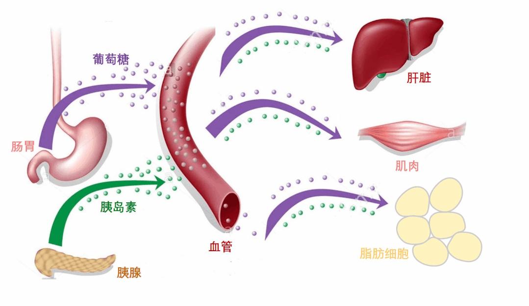 胰岛素抵抗最新治疗进展与策略